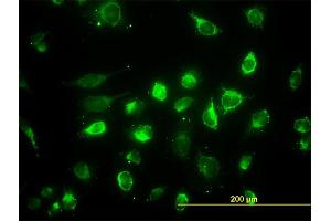 Immunofluorescence of monoclonal antibody to ACAA2 on HeLa cell. (ACAA2 Antikörper  (AA 151-260))