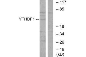 Western blot analysis of extracts from 293 cells, using YTHDF1 antibody.