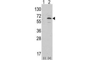 Western blot analysis of APPBP1 (arrow) using rabbit polyclonal APPBP1 Antibody (C-term) (AP13996PU-N ). (NAE1 Antikörper  (C-Term))
