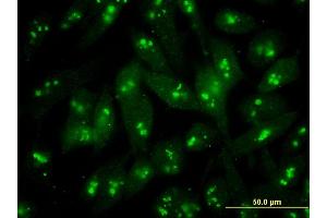 Immunofluorescence of monoclonal antibody to S100B on HeLa cell . (S100B Antikörper  (AA 1-92))
