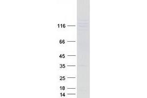 Western Blotting (WB) image for Tight Junction Protein 2 (Zona Occludens 2) (TJP2) (Transcript Variant 1) protein (Myc-DYKDDDDK Tag) (ABIN2733788)