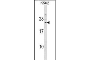 DCAKD Antibody (N-term) (ABIN1539435 and ABIN2849301) western blot analysis in K562 cell line lysates (35 μg/lane). (DCAKD Antikörper  (N-Term))