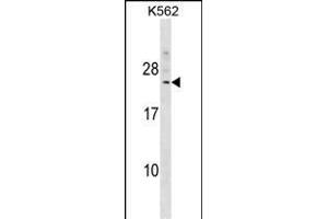 DCAKD Antikörper  (N-Term)