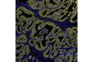 Immunofluorescence (IF) image for anti-Catenin, beta (CATNB) (AA 725-775) antibody (ABIN7455205) (Rekombinanter beta Catenin Antikörper  (AA 725-775))