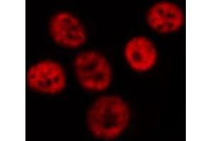 ABIN6267597 staining HeLa by IF/ICC.