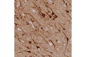 Immunohistochemical staining of human cerebral cortex with MCCD1 polyclonal antibody  shows strong cytoplasmic positivity in neuronal cells at 1:20-1:50 dilution. (MCCD1 Antikörper)