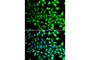 Immunofluorescence analysis of A549 cells using COPS6 antibody.