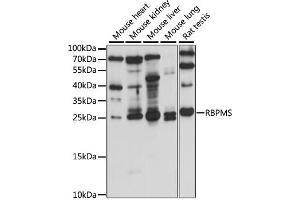 Western blot analysis of extracts of various cell lines, using RBPMS antibody (ABIN7270097) at 1:1000 dilution. (RBPMS Antikörper  (AA 110-219))