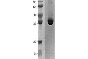 Western Blotting (WB) image for Lactate Dehydrogenase A (LDHA) (Transcript Variant 2) protein (His tag) (ABIN2724572)