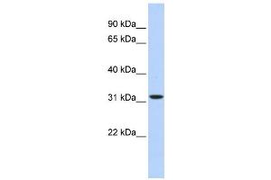 Western Blotting (WB) image for anti-3-hydroxyisobutyrate Dehydrogenase (HIBADH) antibody (ABIN2459627) (HIBADH Antikörper)