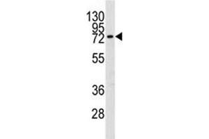 Western blot analysis of MMP9 in mouse spleen lysate. (MMP 9 Antikörper  (AA 644-673))