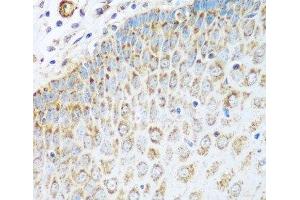 Immunohistochemistry of paraffin-embedded Human esophagus using GLUD1 Polyclonal Antibody at dilution of 1:100 (40x lens).