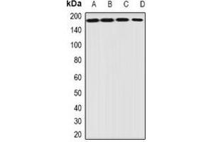 Western blot analysis of EIF3A expression in HepG2 (A), Jurkat (B), mouse heart (C), mouse ovary (D) whole cell lysates. (EIF3A Antikörper)