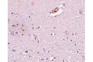 Immunohistochemical staining of human brain tissue with 5 ug/mL ZNF536 polyclonal antibody . (ZNF536 Antikörper  (N-Term))