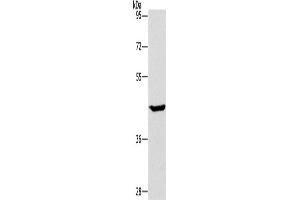 Western Blotting (WB) image for anti-Glucokinase (Hexokinase 4) (GCK) antibody (ABIN2423520)