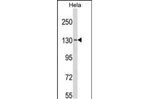 Western blot analysis of C15orf2 Antibody in Hela cell line lysates (35ug/lane) (NPAP1 Antikörper  (AA 348-377))