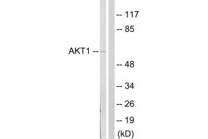 Western blot analysis of extracts from NIH/3T3cells, treated with PDGF (50mg /ml, 20mins), using Akt (epitope around residue 124) Antibody. (AKT1 Antikörper  (Ser124))