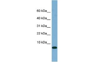 WB Suggested Anti-FABP1 Antibody Titration:  0. (FABP1 Antikörper  (N-Term))