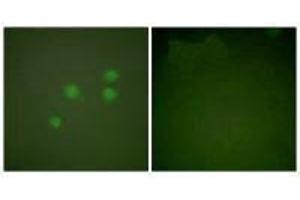 Immunofluorescence analysis of A549 cells, using Cyclin E1 antibody. (Cyclin E1 Antikörper)