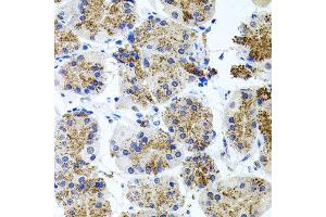 Immunohistochemistry of paraffin-embedded human stomach using SSTR2 antibody at dilution of 1:100 (x40 lens).