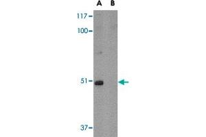 Western blot analysis of FNBP1L in mouse brain tissue lysate with in (A) the absence and (B) the presence of blocking peptide with FNBP1L polyclonal antibody  at 1 ug/mL . (FNBP1L Antikörper  (C-Term))