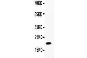 Anti-IL12 p40 Picoband antibody,  All lanes: Anti-IL12 P40 at 0. (IL12B Antikörper  (AA 23-321))