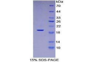 SDS-PAGE (SDS) image for Leukemia Inhibitory Factor Receptor alpha (LIFR) (AA 692-833) protein (His tag) (ABIN1980769)