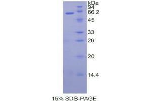 SDS-PAGE analysis of Human TFPI Protein. (TFPI Protein)