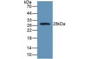 Detection of Recombinant FGFRL1, Rat using Polyclonal Antibody to Fibroblast Growth Factor Receptor Like Protein 1 (FGFRL1) (FGFRL1 Antikörper  (AA 164-368))