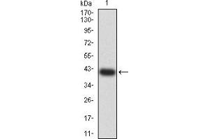 Western blot analysis using F2R mAb against human F2R (AA: 42-176) recombinant protein. (PAR1 Antikörper  (AA 42-176))