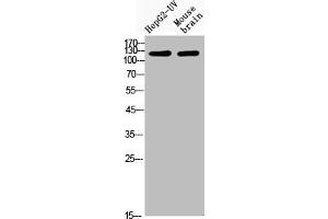 Western Blot analysis of HepG2-UVmouse brain cells using Acetyl-CRM1 (K568) Polyclonal Antibody (XPO1 Antikörper  (acLys568))