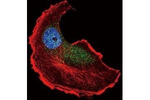 Immunofluorescence (IF) image for anti-Tuberous Sclerosis 2 (TSC2) (pSer1798) antibody (ABIN3029328)