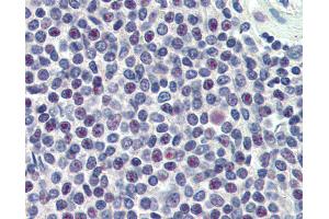 Anti-HMG20A antibody IHC of human spleen. (HMG20A Antikörper  (AA 336-347))