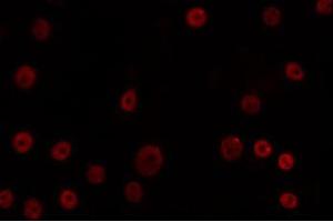 ABIN6266690 staining K562 by IF/ICC. (OVOL1 Antikörper  (N-Term))