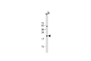 Western Blotting (WB) image for anti-Von Hippel-Lindau Tumor Suppressor, E3 Ubiquitin Protein Ligase (VHL) (AA 181-210), (C-Term) antibody (ABIN390463)