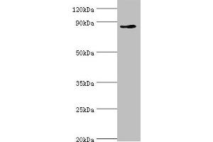 Western blot All lanes: CDH11 antibody at 6 μg/mL + Jurkat whole cell lysate Secondary Goat polyclonal to rabbit IgG at 1/10000 dilution Predicted band size: 88, 77 kDa Observed band size: 88 kDa (OB Cadherin Antikörper  (AA 637-796))