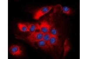 Immunofluorescent analysis of BCL2 (pT56) staining in A549 cells. (Bcl-2 Antikörper  (pSer56))