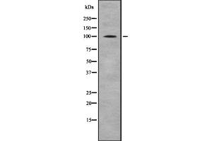 Western blot analysis of CTNNA1/CTNNA2 using HeLa whole cell lysates (CTNNA2 Antikörper  (C-Term))