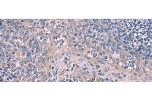 Immunohistochemistry of paraffin-embedded Human tonsil tissue using ITPR2 Polyclonal Antibody at dilution of 1:65(x200) (ITPR2 Antikörper)