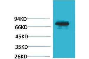Western Blotting (WB) image for anti-Transferrin (TF) antibody (ABIN3179061) (Transferrin Antikörper)
