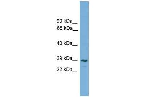 WB Suggested Anti-CLEC4M Antibody Titration:  0. (C-Type Lectin Domain Family 4, Member M (CLEC4M) (Middle Region) Antikörper)