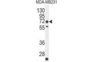 Western blot analysis in MDA-MB231 cell line lysates (35ug/lane) using C18orf8/MIC1 Antibody (N-term). (C18orf8 Antikörper  (N-Term))