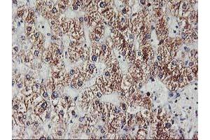 Immunohistochemical staining of paraffin-embedded Human liver tissue using anti-EXOSC7 mouse monoclonal antibody. (EXOSC7 Antikörper)