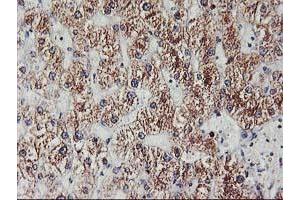 Immunohistochemical staining of paraffin-embedded Human liver tissue using anti-EXOSC7 mouse monoclonal antibody. (EXOSC7 Antikörper)