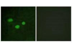 Immunofluorescence analysis of HeLa cells, using DNMT3B antibody. (DNMT3B Antikörper  (N-Term))