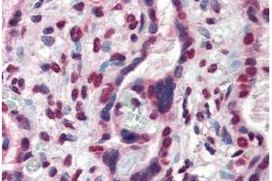 Human Placenta (formalin-fixed, paraffin-embedded) stained with ATF6 antibody ABIN337286 at 10 ug/ml followed by biotinylated anti-mouse IgG secondary antibody ABIN481714, alkaline phosphatase-streptavidin and chromogen.