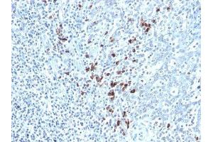 Image no. 1 for Mouse anti-Human kappa Light Chain antibody (ABIN6174069) (Maus anti-Human kappa Light Chain Antikörper)