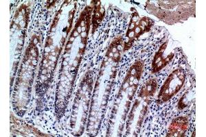 Immunohistochemistry (IHC) image for anti-Interleukin 1 Receptor, Type II (IL1R2) (Internal Region) antibody (ABIN6281356)