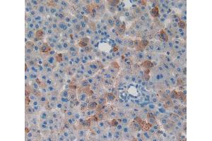 IHC-P analysis of liver tissue, with DAB staining. (MYO1F Antikörper  (AA 655-922))
