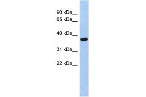 WB Suggested Anti-PPAPDC2 Antibody Titration: 0. (PPAPDC2 Antikörper  (N-Term))